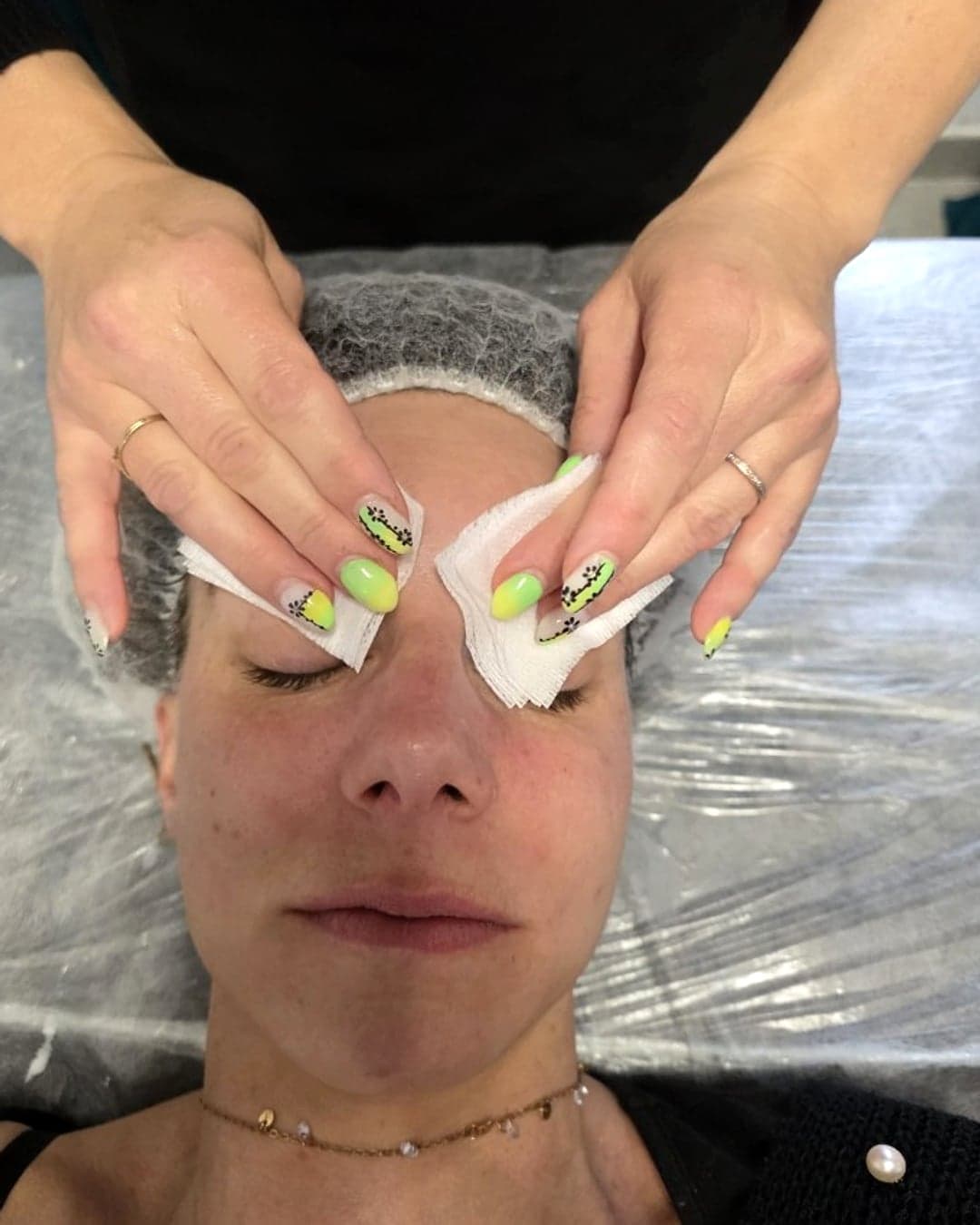 Nettoyage du visage au coton avant microneedling