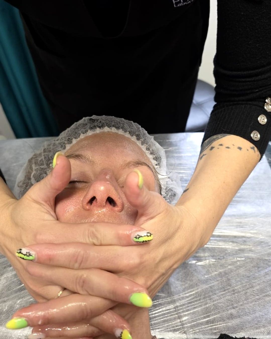 Gommage du visage avant microneedling